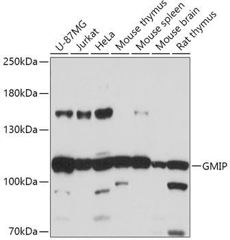 GMIP Polyclonal Antibody