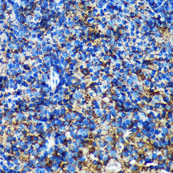 GMIP Polyclonal Antibody