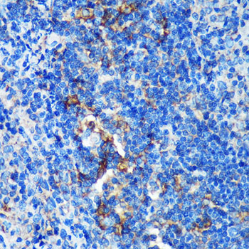 GMIP Polyclonal Antibody