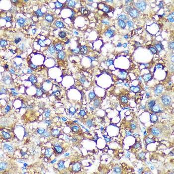 GMIP Polyclonal Antibody