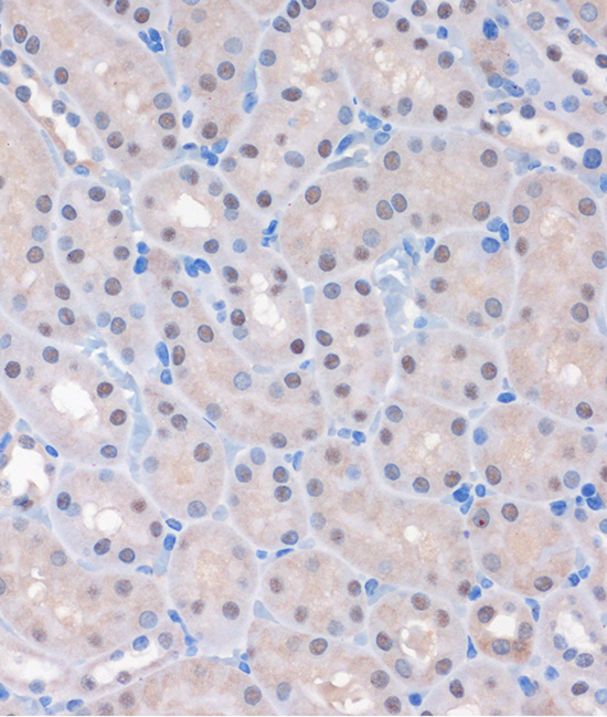MTMR8 Polyclonal Antibody