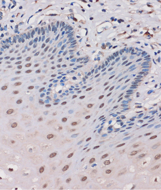 MTMR8 Polyclonal Antibody