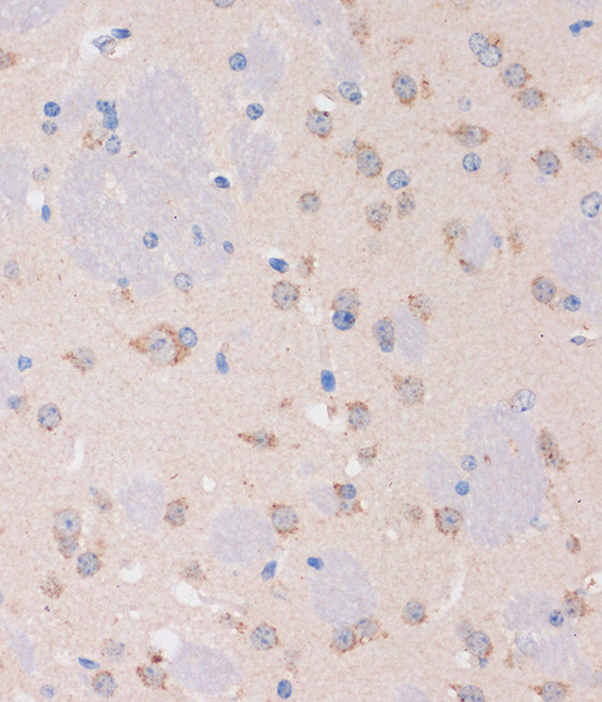 STIM2 Polyclonal Antibody
