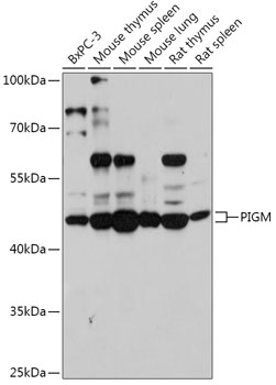 PIGM Polyclonal Antibody