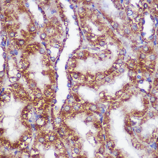 PIGM Polyclonal Antibody