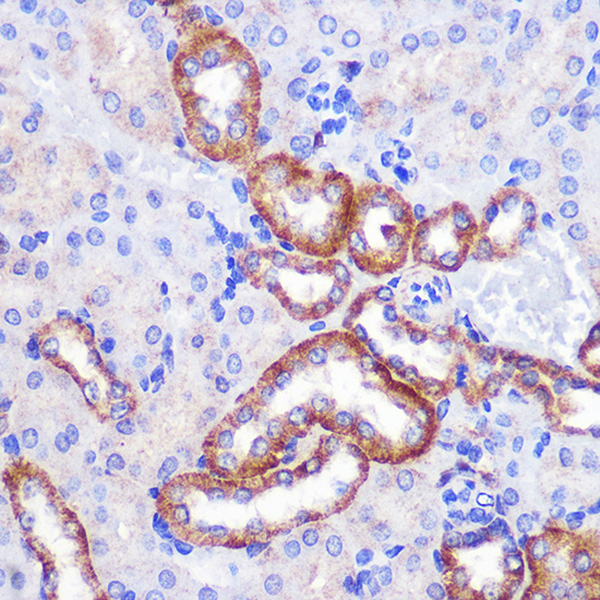 PIGM Polyclonal Antibody