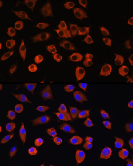 PIGM Polyclonal Antibody