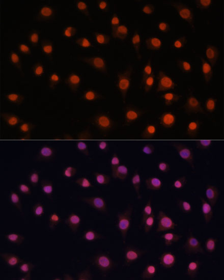 H2AFV Polyclonal Antibody
