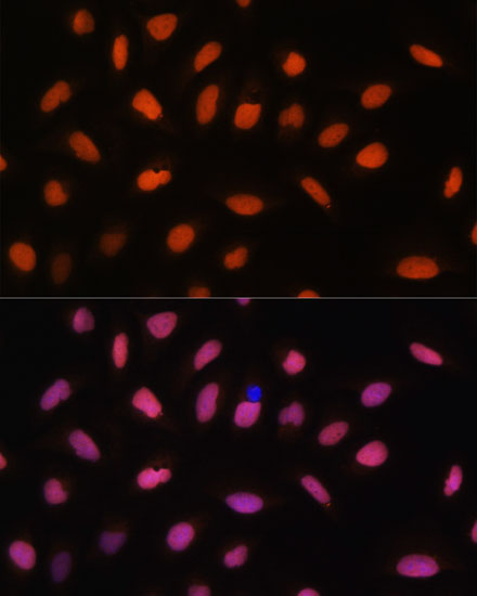 H2AFV Polyclonal Antibody