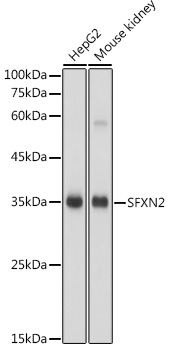 SFXN2 Polyclonal Antibody