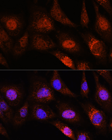 ZC3H12D Polyclonal Antibody