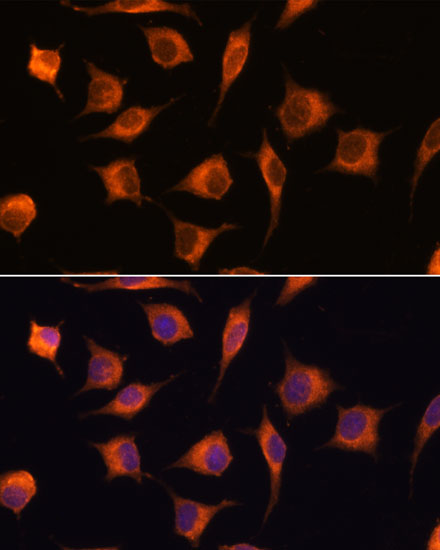 GBAS Polyclonal Antibody
