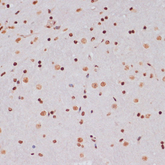 Acetyl-Histone H3-K9/K14/K18/K23/K27 pAb