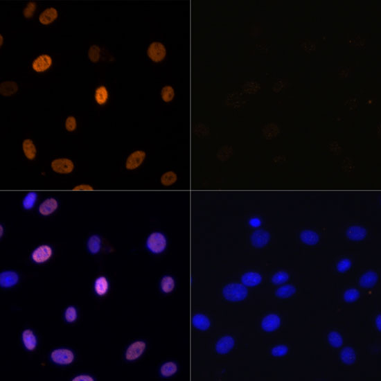 Acetyl-Histone H3-K9/K14/K18/K23/K27 pAb