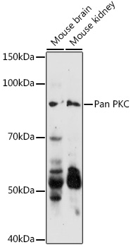 PRKCA/PRKCB/PRKCD/PRKCE/PRKCG/PRKCH/PRKCI/PRKCQ/PRKCZ Polyclonal Antibody