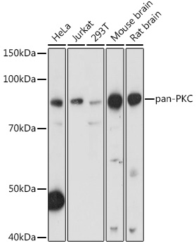 PRKCA/PRKCB/PRKCD/PRKCE/PRKCH/PRKCQ Polyclonal Antibody