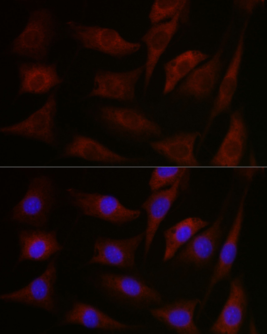 PRKCA/PRKCB/PRKCD/PRKCE/PRKCH/PRKCQ Polyclonal Antibody