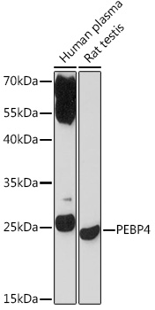 PEBP4 Polyclonal Antibody