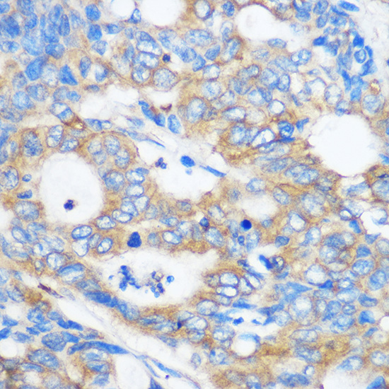 PEBP4 Polyclonal Antibody