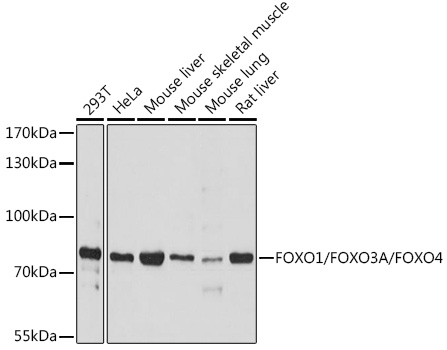 FoxO1/FoxO3a/FoxO4 Polyclonal Antibody