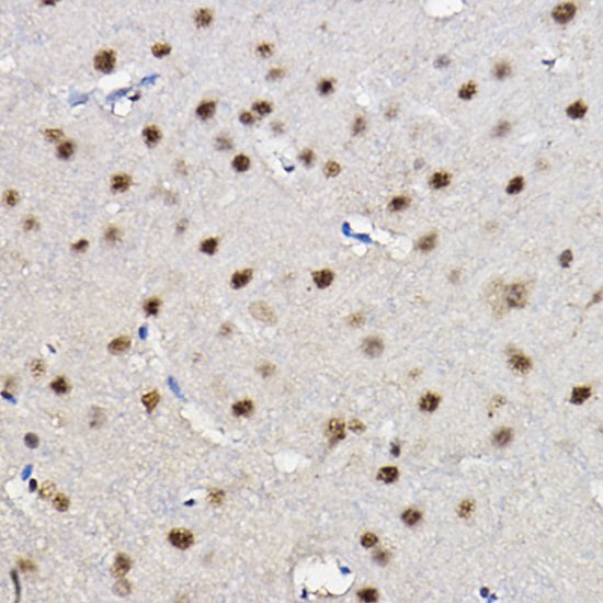 FoxO1/FoxO3a/FoxO4 Polyclonal Antibody