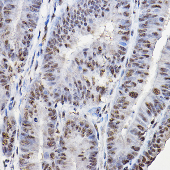 FoxO1/FoxO3a/FoxO4 Polyclonal Antibody