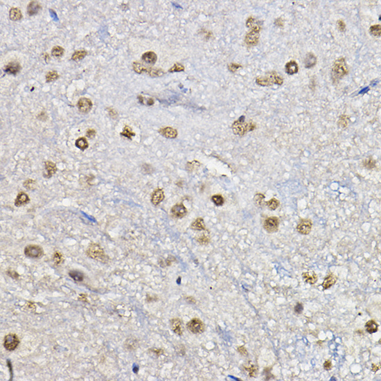 FoxO1/FoxO3a/FoxO4 Polyclonal Antibody