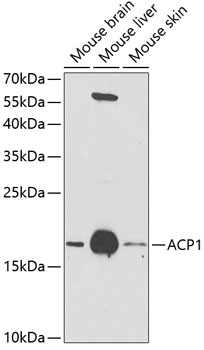 ACP1 Polyclonal Antibody