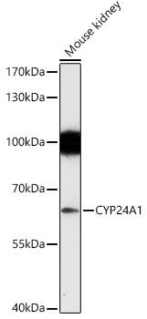 CYP24A1 Polyclonal Antibody