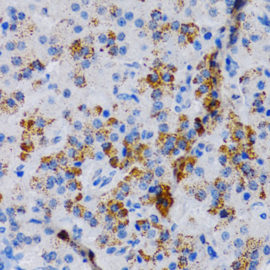 CYP24A1 Polyclonal Antibody