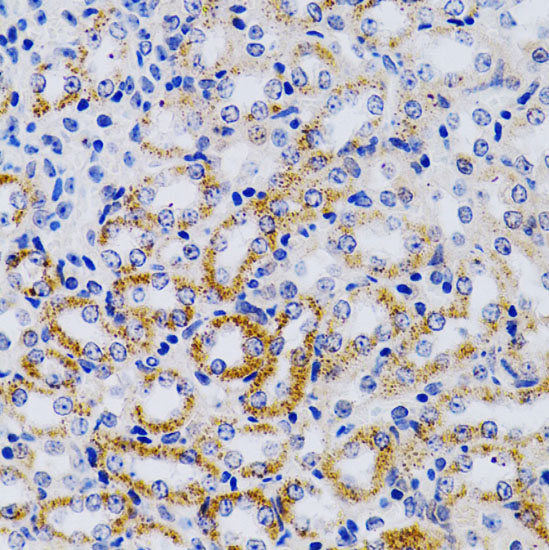 CYP24A1 Polyclonal Antibody