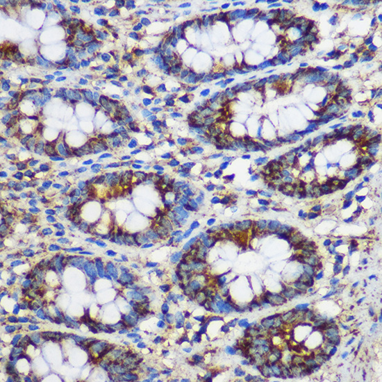 TEX101 Polyclonal Antibody