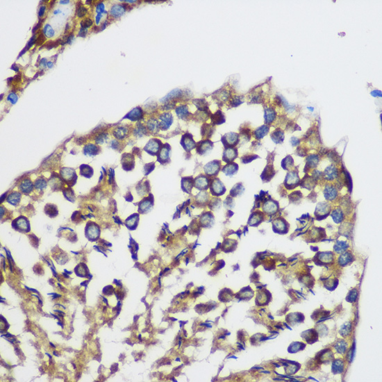 TEX101 Polyclonal Antibody