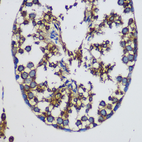 TEX101 Polyclonal Antibody