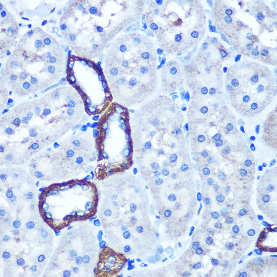 TBCCD1 Polyclonal Antibody