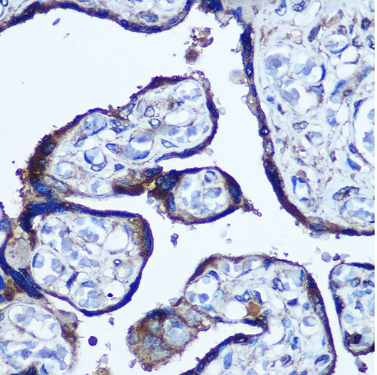 TBCCD1 Polyclonal Antibody