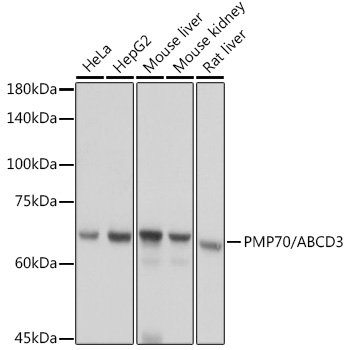 ABCD3 Polyclonal Antibody