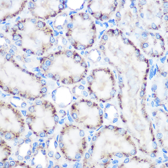 ABCD3 Polyclonal Antibody