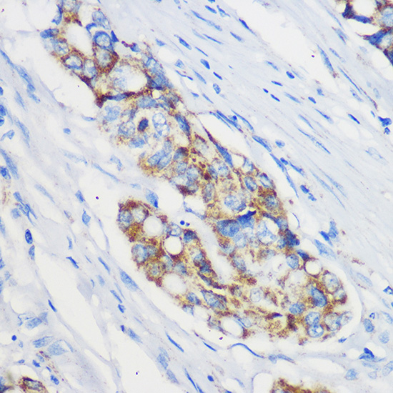 Mrpl46 Polyclonal Antibody