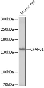 CFAP61 Polyclonal Antibody