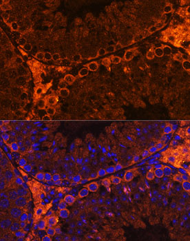 CFAP61 Polyclonal Antibody