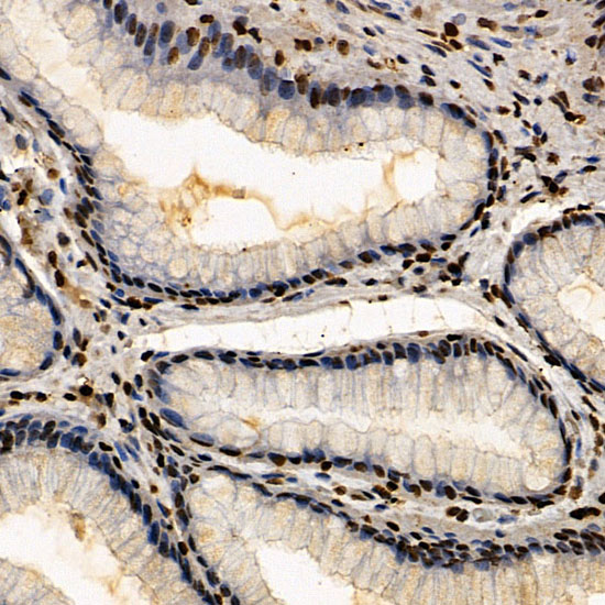 ERCC6 Polyclonal Antibody
