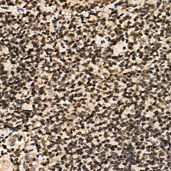 ERCC6 Polyclonal Antibody