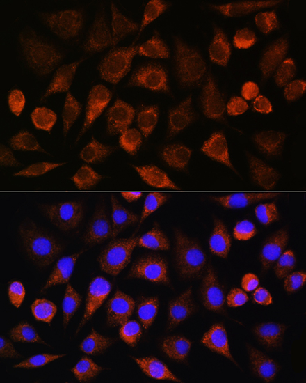 BRINP3 Polyclonal Antibody