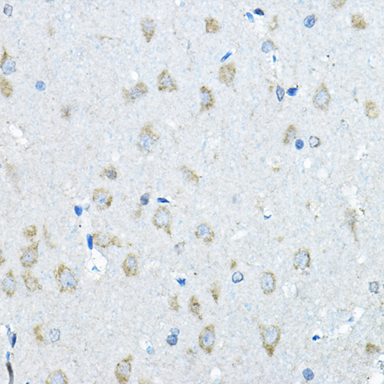 IDS Polyclonal Antibody
