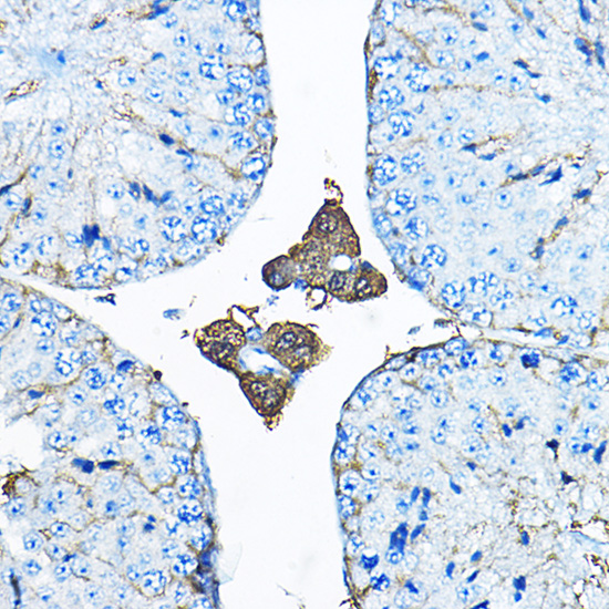 IDS Polyclonal Antibody