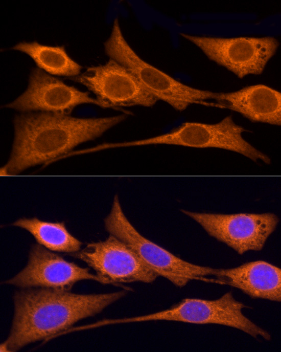 IDS Polyclonal Antibody