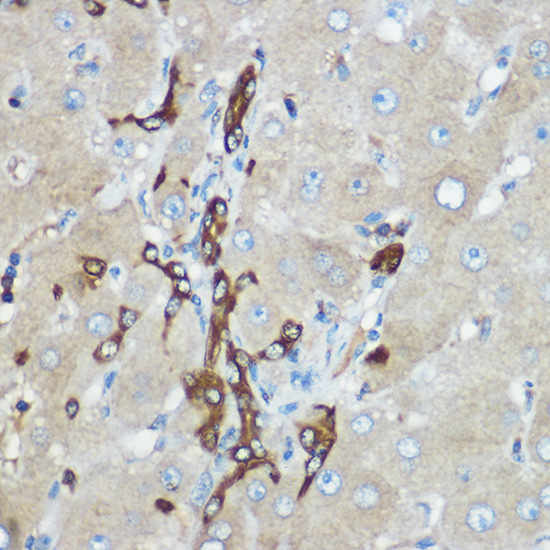 CAPN2 Polyclonal Antibody