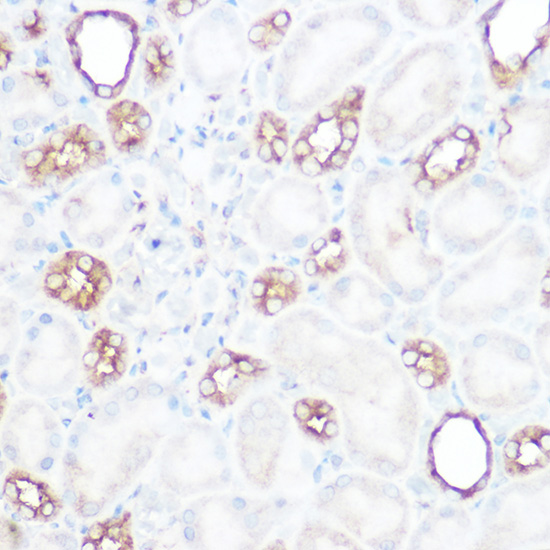 CAPN2 Polyclonal Antibody