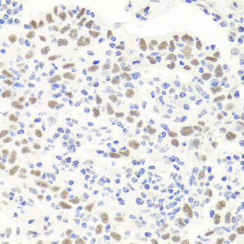 EXO1 Polyclonal Antibody